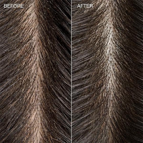 Close-up of horse fur before and after a treatment, showing a difference using Paul Mitchell Tea Tree Special Detox Foaming Salt Scrub for scalp buildup flakes and excess oil in Canada
